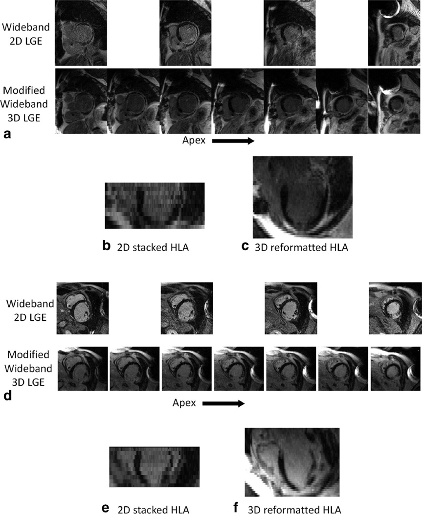 FIG. 9