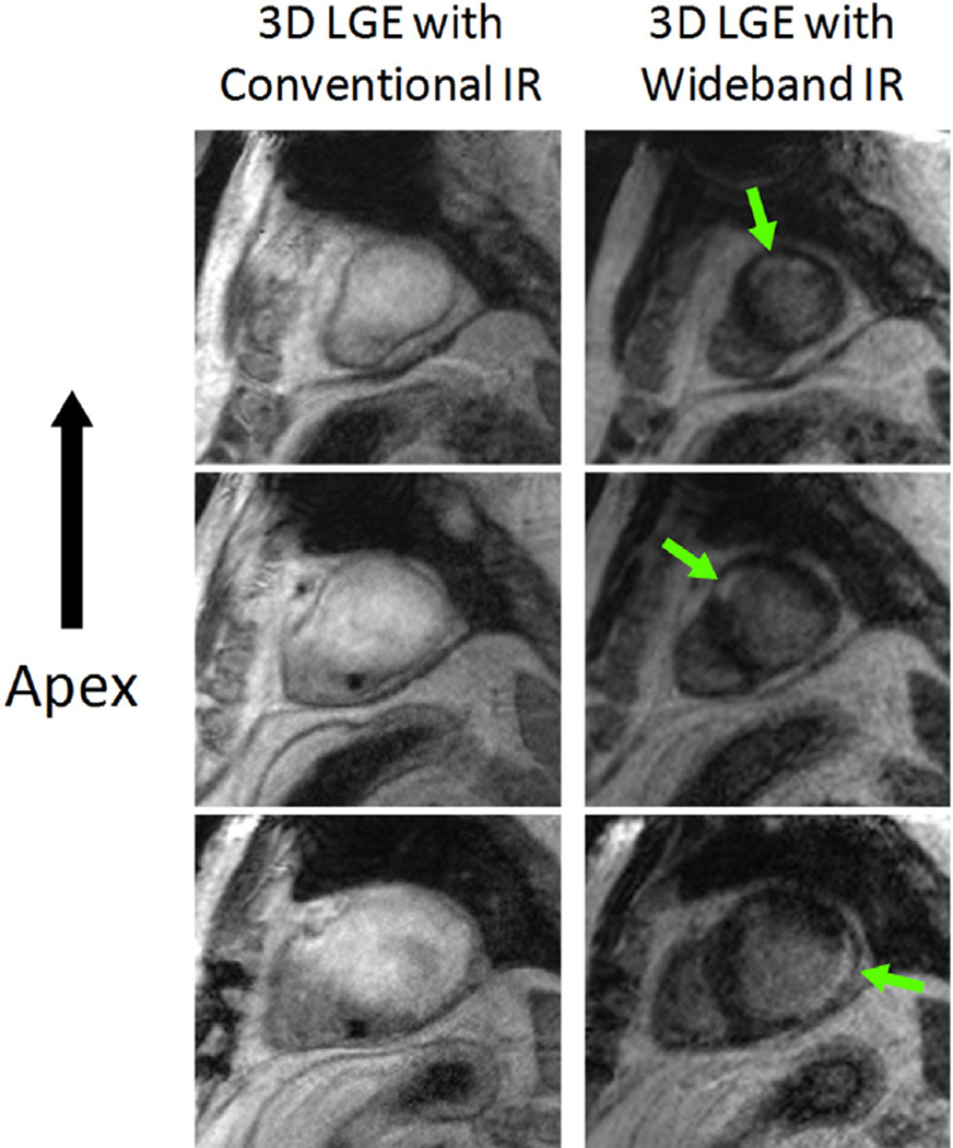 FIG. 7