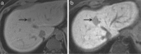 Fig 1.