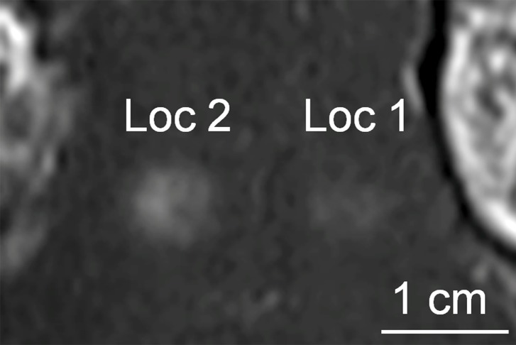 Figure 4a: