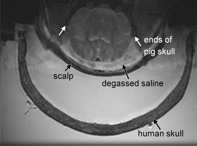 Figure 1b: