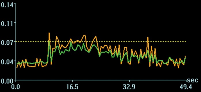 Figure 4d: