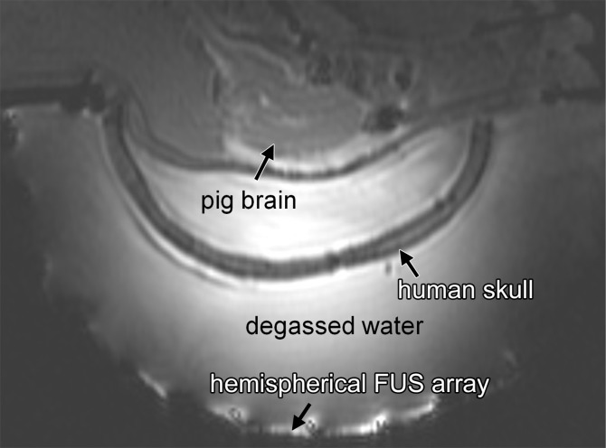 Figure 1a: