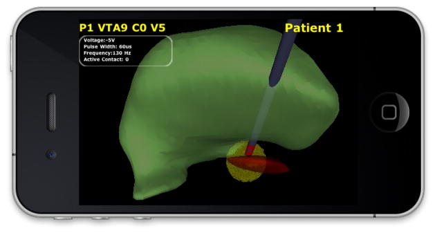 Fig. 1