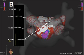 Figure 4B