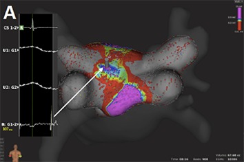 Figure 4A