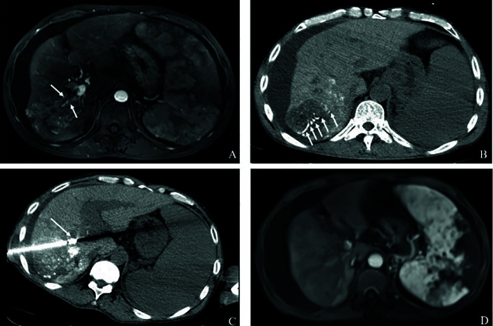 Figure 2A