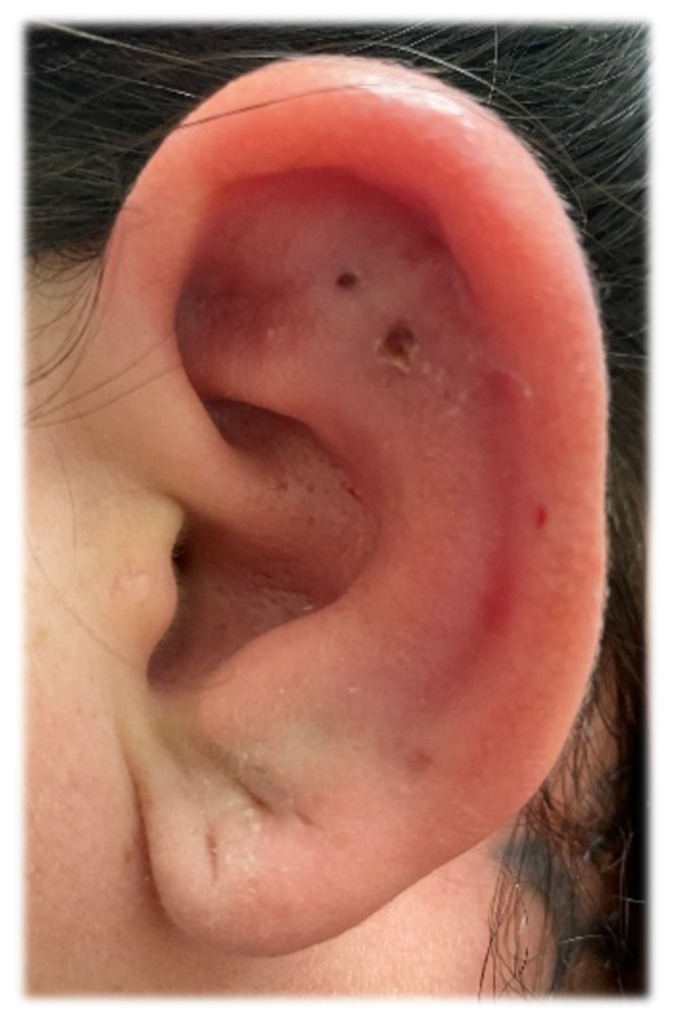 graphic file with name jetem-6-2-v30f1.jpg