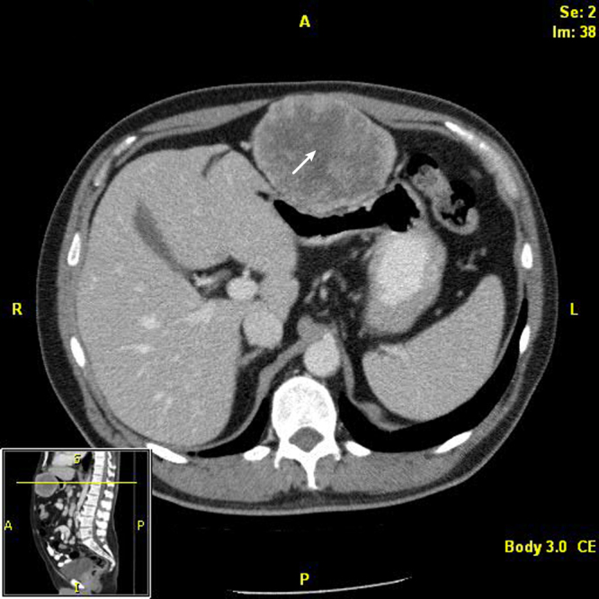 Fig. 1