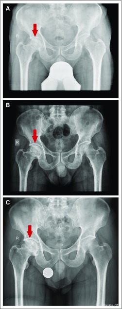 Fig 3