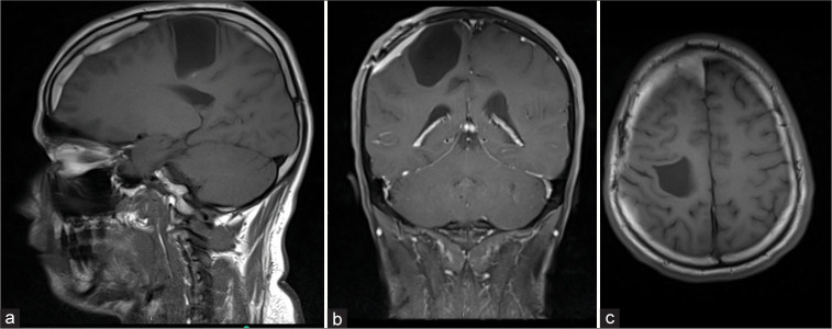 Figure 4: