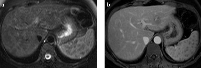 Figure 5. a, b.