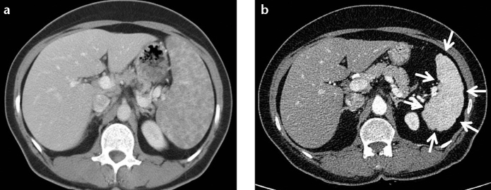 Figure 7. a, b.