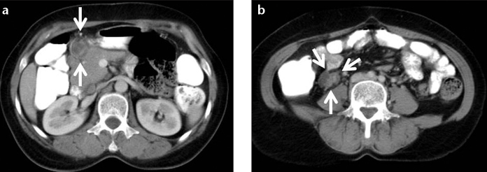 Figure 10. a, b.