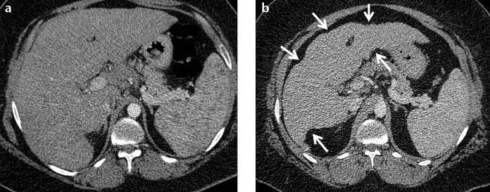 Figure 4. a, b.