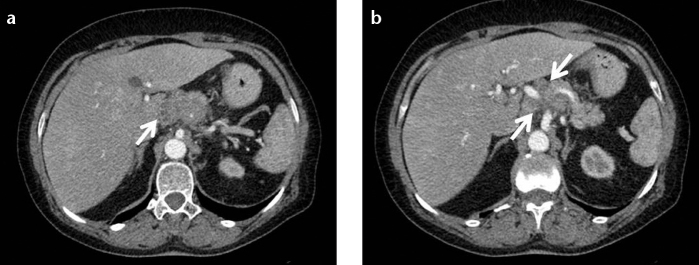 Figure 12. a, b.