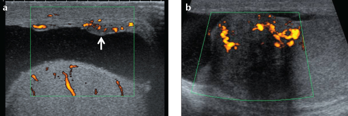 Figure 15. a, b.