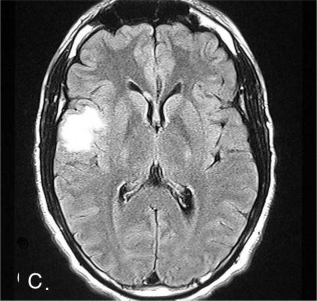 Figure 1C