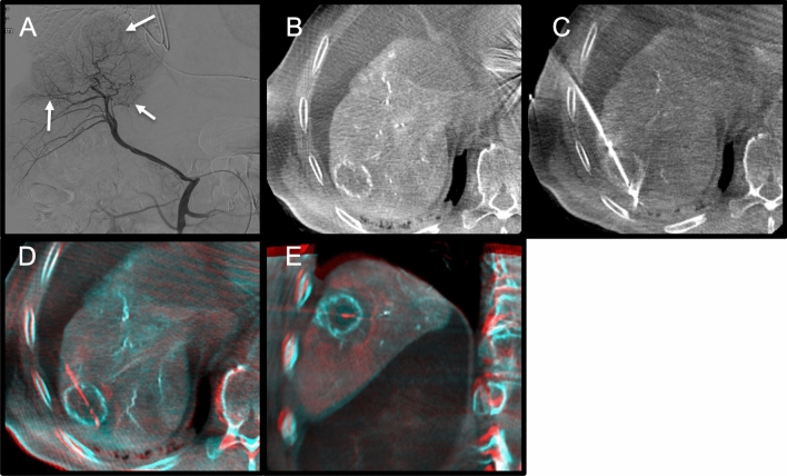 Fig. 4