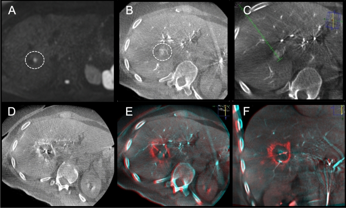 Fig. 5