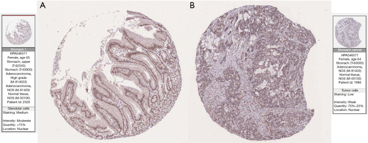 Figure 12