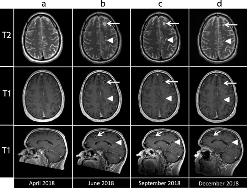 Fig. 2