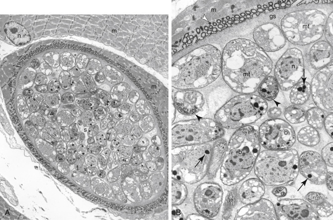 Figure 17-4