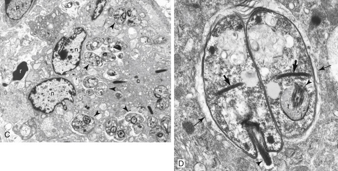 Figure 17-4