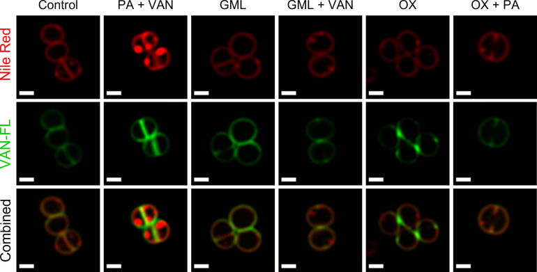 Figure 4—figure supplement 2.