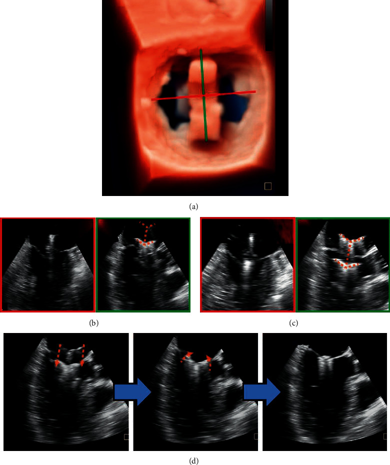 Figure 4