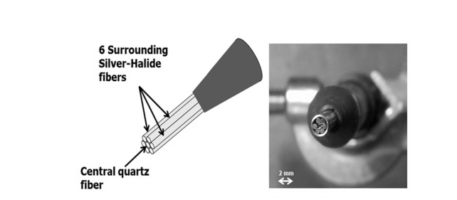 Fig. 2