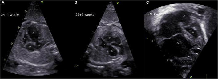 FIGURE 3