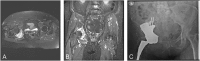 Fig. 2A-C