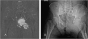Fig. 3A-B