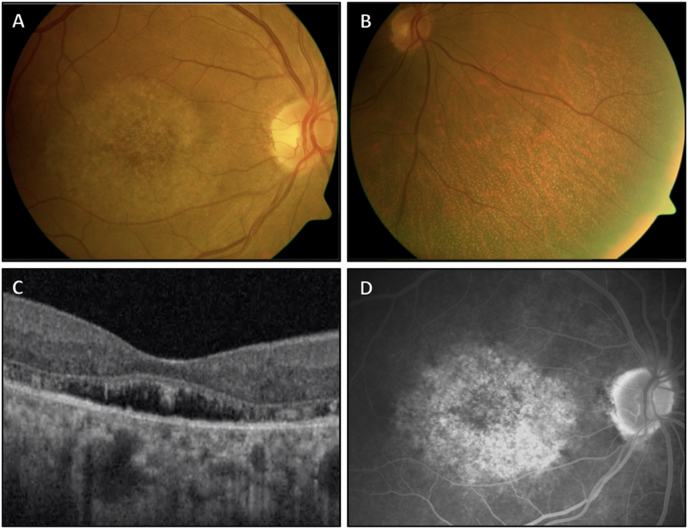 Fig. 1