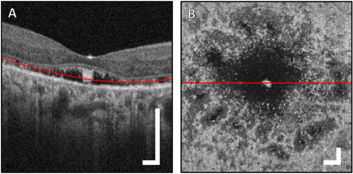 Fig. 4