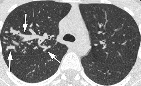 Figure 3c: