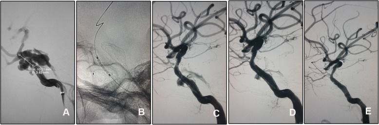 Fig. 4