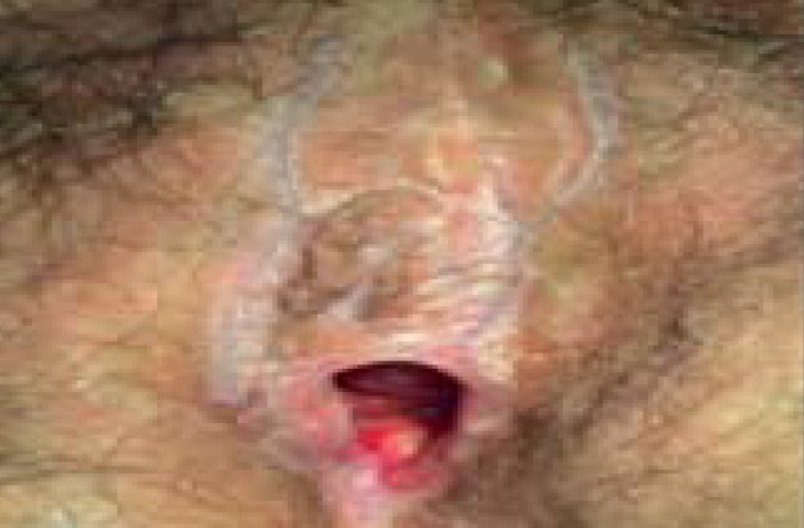 graphic file with name Dtsch_Arztebl_Int-117_0126_005.jpg