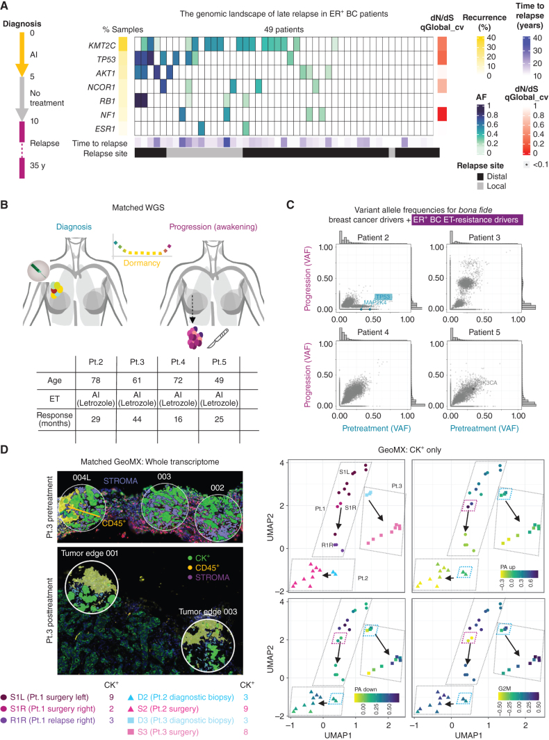 Figure 1. Genetic profile of tumor awakening in the clinical setting. A, High-depth profiling (median 105.47×) of ER+ breast cancer (BC; estrogen receptor–positive breast cancer) late relapses using a custom targeted panel. The simplified treatment scheme of patients is shown on the left. The heat map shows the mutations in ET resistance drivers in ER+ breast cancer passing the filters for allele depth ≥ 20, Alternate F1R2 + F2R1 ≥ 4, allele frequency ≥ 0.1, and consequence level of moderate or high. Time to relapse, recurrence in the data set, allele frequency, and relapse site are indicated. Significant genes are indicated based on dN/dS analysis from the q-value of neutrality test at the gene level (*qglobal_cv ≤ 0.1). B, Clinical histories of patients 2–5. The table shows age and response time to ET for each patient (letrozole). C, Scatter plots of VAF from whole-genome sequencing (WGS) data. Pairwise comparisons were done for pretreatment (diagnostic biopsies) versus progression (surgical biopsies). All patients were managed with primary endocrine therapy until progression. Labeled genes passed two filters: bona fide breast cancer drivers and ET resistance drivers in ER+ breast cancer and FATHMM significant score >0.6 (predicted damaging). Detected variants are labeled and color-coded according to detection at diagnosis (teal), progression (magenta), or both (gray). The highlighted gene (TP53) is annotated as a variant detected in ET resistance drivers in ER+ breast cancer according to the comprehensive ET-resistance driver gene list compiled based on Bertucci et al. (14). Marginal histograms of VAFs are shown on the sides of each plot. D, Spatial transcriptomics analysis of patients 1–3. On the left, representative images of regions of interest (ROI) from patient 3, pre- and post-treatment, are shown with the relevant staining. Green, pan cytokeratin (CK+); yellow, immune cells (CD45+); purple, stroma. On the right side, GeoMx UMAPs of previously identified pre-adapted SWNE up and down signatures from (2), and G2–M checkpoint signatures are shown for patients 1–3 (CK+ segment). D1 L biopsy was not suitable for spatial transcriptomics analysis due to poor specimen quality and was excluded from further examinations. S1L: surgical biopsy in the left breast; S1R: surgical biopsy in the right breast; R1R: loco-regional relapse after surgery in the right breast.