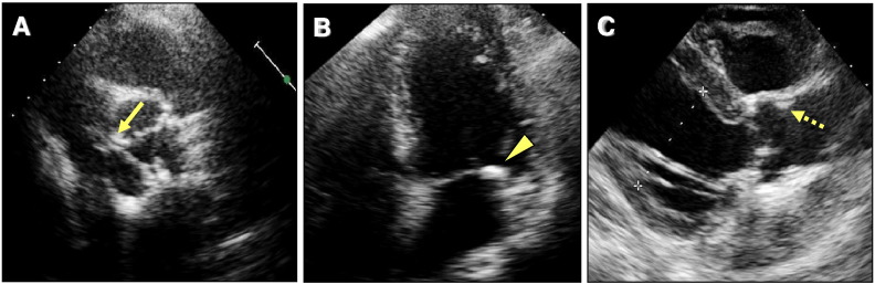 Fig. 1