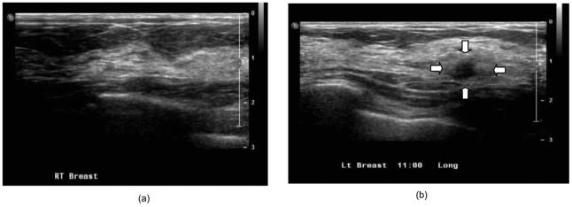 Fig. 11