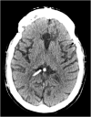 Fig. 8