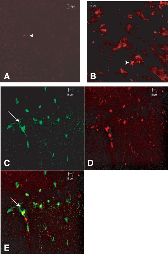 Figure 11.