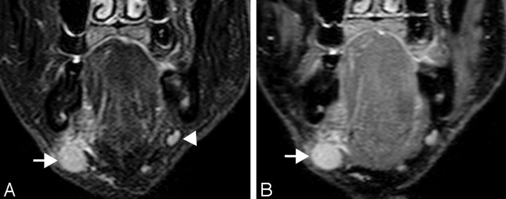 Fig 2.