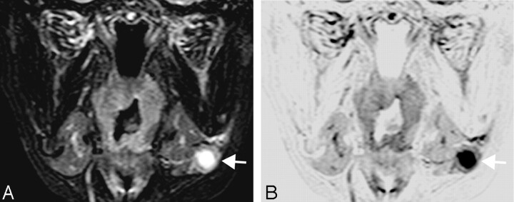 Fig 3.