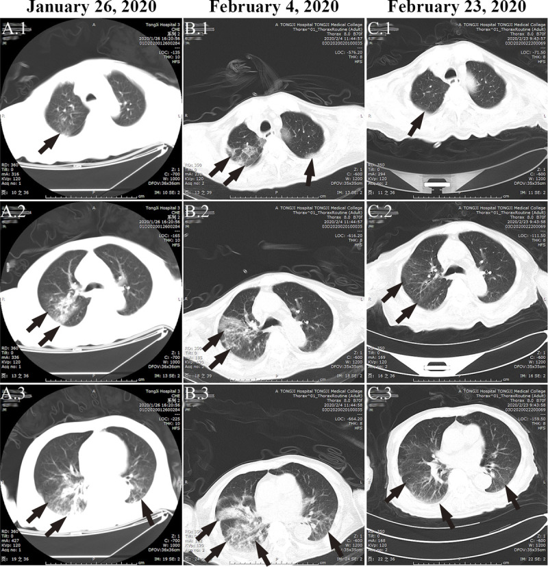 FIGURE 1