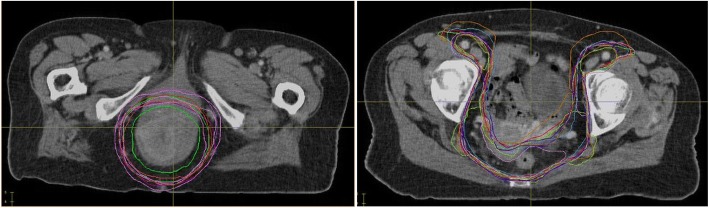 Fig. 3