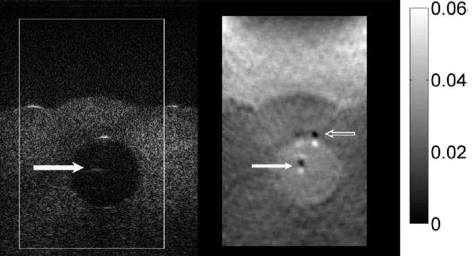 Fig. 15