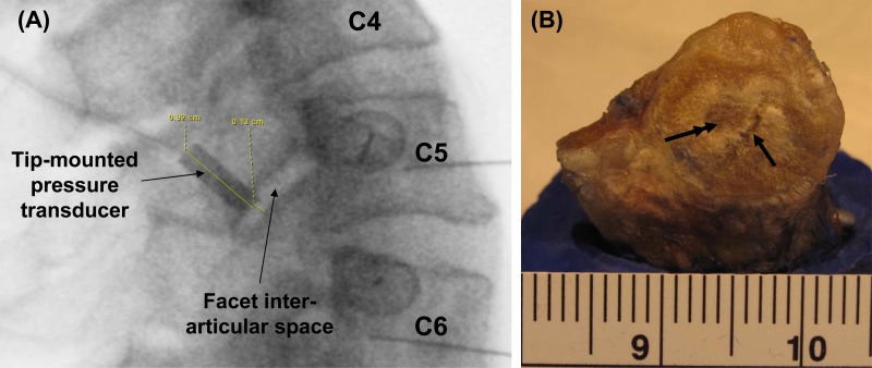 Fig. 5